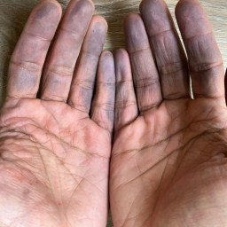 hands & i